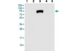 Western blot analysis of Lane 1: RT-4, Lane 2: U-251 MG, Lane 3: Human Plasma, Lane 4: Liver, Lane 5: Tonsil with IGFALS polyclonal antibody  at 1:250-1:500 dilution. (IGFALS antibody)