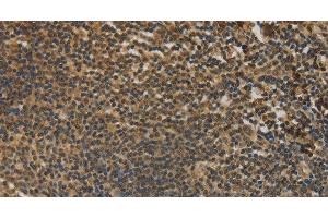 Immunohistochemistry of paraffin-embedded Human tonsil tissue using DACH1 Polyclonal Antibody at dilution 1:50 (DACH1 antibody)
