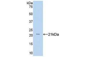 WB of Protein Standard: different control antibodies against Highly purified E. (TNF alpha ELISA Kit)
