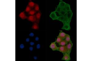 ABIN6256090 and ABIN6267276 staining Hela cells(24h of starvation treatment) by IF/ICC.