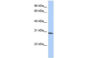ZFYVE28 antibody used at 0. (ZFYVE28 antibody  (N-Term))