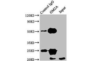 Immunoprecipitating GM2A in HEK293 whole cell lysate Lane 1: Rabbit control IgG instead of ABIN7153574 in HEK293 whole cell lysate. (GM2A antibody  (AA 32-193))