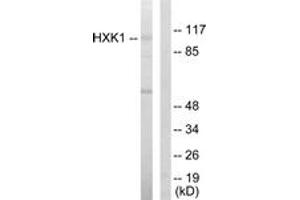 Western blot analysis of extracts from HeLa cells, using HXK1 Antibody.