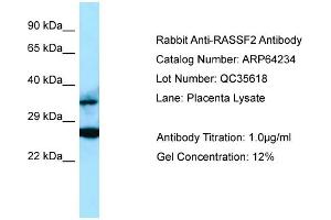 Western Blotting (WB) image for anti-Ras Association (RalGDS/AF-6) Domain Family Member 2 (RASSF2) (C-Term) antibody (ABIN971538) (RASSF2 antibody  (C-Term))
