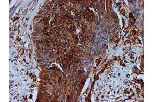 Image no. 1 for anti-Tubulin beta 4a (TUBB4A) antibody (ABIN1501579) (TUBB4 antibody)