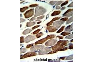 Immunohistochemistry (IHC) image for anti-Elastin Microfibril Interfacer 1 (EMILIN1) antibody (ABIN3002724) (Emilin1 antibody)
