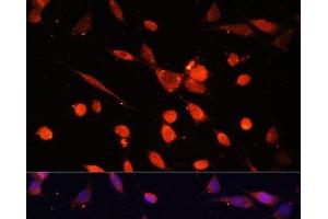 Immunofluorescence analysis of NIH-3T3 cells using PIK3R3 Polyclonal Antibody at dilution of 1:100. (PIK3R3 antibody)