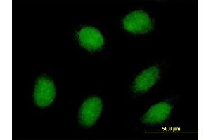 Immunofluorescence of purified MaxPab antibody to EXOSC1 on HeLa cell. (EXOSC1 antibody  (AA 1-195))