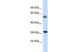 Host:  Rabbit  Target Name:  PCGF3  Sample Type:  Fetal Muscle lysates  Antibody Dilution:  1. (PCGF3 antibody  (Middle Region))