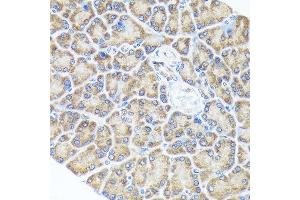 Immunohistochemistry of paraffin-embedded rat pancreas using Sprouty 2 Rabbit mAb (ABIN7270554) at dilution of 1:100 (40x lens). (SPRY2 antibody)