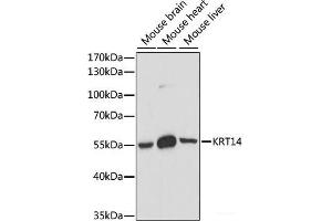 Western blot analysis of extracts of various cell lines using KRT14 Polyclonal Antibody at dilution of 1:1000. (KRT14 antibody)