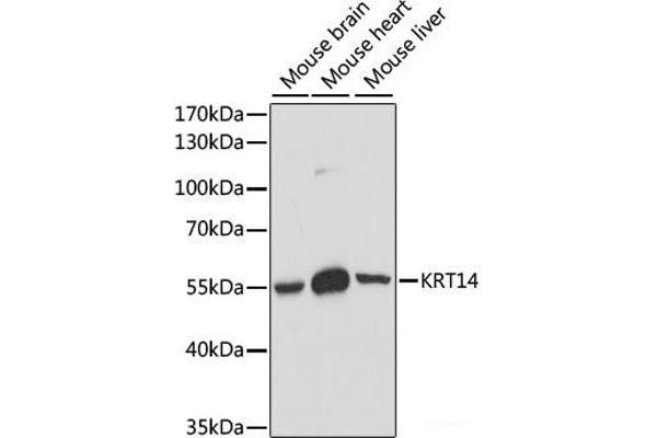 KRT14 anticorps