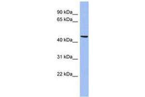 Image no. 1 for anti-Matrilin 3 (MATN3) (AA 71-120) antibody (ABIN6744055) (Matrilin 3 antibody  (AA 71-120))