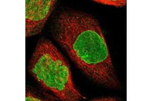 Immunofluorescent staining of A-431 cells with BRIP1 polyclonal antibody  (Green) shows positivity in nucleus and nuclear membrane.