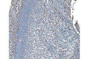 IHC analysis of SND1 using anti-SND1 antibody (ABIN7600526).