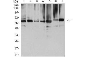 Western Blotting (WB) image for anti-ARD1 Homolog, N-Acetyltransferase (ARD1A) (AA 111-235) antibody (ABIN5611234)