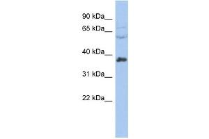RALY antibody used at 1 ug/ml to detect target protein. (Raly antibody  (Middle Region))