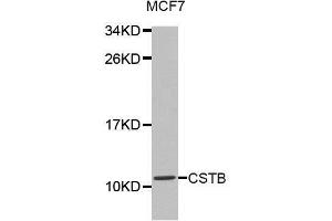 Western blot analysis of extracts of MCF7 cell lines, using CSTB antibody. (CSTB antibody  (AA 1-98))