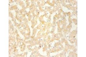 Immunohistochemistry of paraffin-embedded human liver using ABIN7146123 at dilution 1:100 (CXCL13 antibody  (AA 23-95))