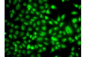Immunofluorescence analysis of A549 cells using TBL1XR1 antibody. (TBL1XR1 antibody)