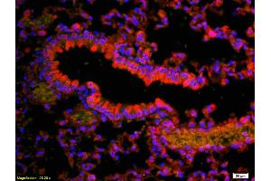 Formalin-fixed and paraffin-embedded rat lung labeled with Anti-Vitamin D Receptor/VDR Polyclonal Antibody, Unconjugated (ABIN682513) 1:200, overnight at 4°C, The secondary antibody was Goat Anti-Rabbit IgG, Cy3 conjugated used at 1:200 dilution for 40 minutes at 37°C. (Vitamin D Receptor antibody  (AA 65-180))