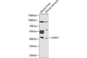 Western blot analysis of extracts of various cell lines, using V antibody (ABIN6128152, ABIN6150060, ABIN6150062 and ABIN6216248) at 1:1000 dilution. (VASH1 antibody  (AA 1-365))