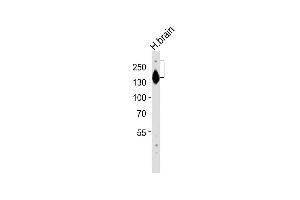 Anti-SPTAN1 Antibody (Center) at 1:2000 dilution + human brain lysates Lysates/proteins at 20 μg per lane. (SPTAN1 antibody  (AA 977-991))