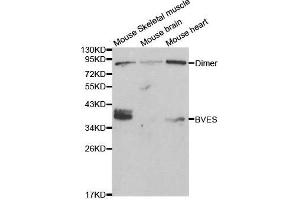 Western blot analysis of extracts of various cell lines, using BVES antibody. (BVES antibody  (AA 241-360))