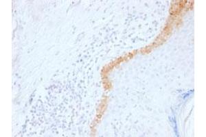 Immunohistochemical staining (Formalin-fixed paraffin-embedded sections) of human skin with KRT15 monoclonal antibody, clone LHK15 . (KRT15 antibody  (C-Term))