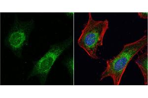 ICC/IF Image Dishevelled 3 antibody [N1N2], N-term detects Dishevelled 3 protein at cytoplasm by immunofluorescent analysis. (DVL3 antibody  (N-Term))