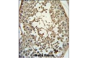 CH Antibody (Center) (ABIN651719 and ABIN2840373) immunohistochemistry analysis in formalin fixed and paraffin embedded human testis tissue followed by peroxidase conjugation of the secondary antibody and DAB staining.