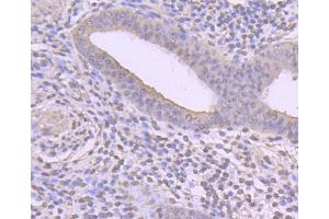 Paraformaldehyde-fixed, paraffin embedded human uterus tissue, Antigen retrieval by boiling in sodium citrate buffer (pH6) for 15min, Block endogenous peroxidase by 3% hydrogen peroxide for 30 minutes, Blocking buffer at 37°C for 20min, Antibody incubation with Cyclin A2 (2E9) Monoclonal Antibody  at 1:50 overnight at 4°C, followed by a conjugated secondary and DAB staining. (Cyclin A antibody)