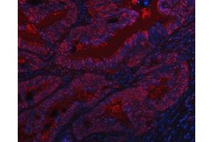 IF analysis of SAP130 using anti-SAP130 antibody (ABIN7601247). (SAP130 antibody  (AA 309-913))