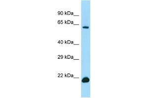 WB Suggested Anti-IRF2BP2 Antibody Titration: 1. (IRF2BP2 antibody  (C-Term))