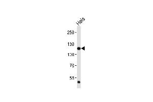 Western blot analysis of lysate from Hela cell line, using FGFR1 Antibody (C-term) (ABIN6243222 and ABIN6577089). (FGFR1 antibody  (C-Term))