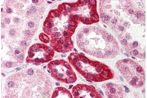 Human Kidney (formalin-fixed, paraffin-embedded) stained with SUMO1 antibody ABIN214521 at 5 ug/ml followed by biotinylated goat anti-rabbit IgG secondary antibody ABIN481713, alkaline phosphatase-streptavidin and chromogen. (SUMO1 antibody  (N-Term))
