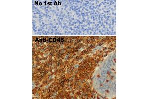 Immunohistochemistry (IHC) image for anti-Protein tyrosine Phosphatase, Receptor Type, C (PTPRC) (C-Term) antibody (ABIN6254210) (CD45 antibody  (C-Term))