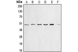 Western blot analysis of Cyclin E1 expression in HEK293T (A), mouse brain (B), PC12 (C), SW626 (D), HeLa (E), K562 (F) whole cell lysates. (Cyclin E1 antibody  (Center))