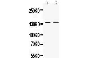 Observed bind size: 140KD (RENT1/UPF1 antibody  (Middle Region))
