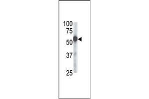 Image no. 1 for anti-Zinc Metalloproteinase, Ste24 (Zmpste24) (Middle Region) antibody (ABIN357707) (ZMPSTE24 antibody  (Middle Region))