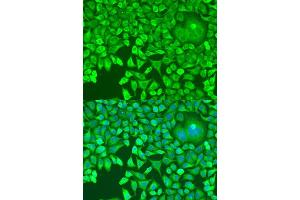 Immunofluorescence analysis of U2OS cells using Pumilio 1 antibody (ABIN6132539, ABIN6146494, ABIN6146496 and ABIN6217367) at dilution of 1:100. (PUM1 antibody  (AA 1-130))