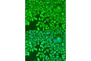 Immunofluorescence analysis of U2OS cells using Pumilio 1 antibody (ABIN6132539, ABIN6146494, ABIN6146496 and ABIN6217367) at dilution of 1:100.