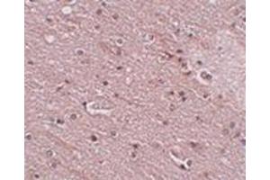 Immunohistochemistry of FRMPD4 in human brain tissue with this product at 5 μg/ml. (Anoctamin 2 antibody  (N-Term))