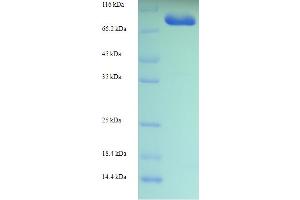 SDS-PAGE (SDS) image for Myosin XIX (MYO19) (AA 2-770) protein (His-SUMO Tag) (ABIN4975612) (Myosin XIX Protein (MYO19) (AA 2-770) (His-SUMO Tag))