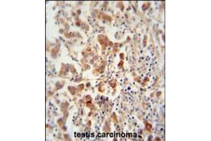 TEX13B antibody immunohistochemistry analysis in formalin fixed and paraffin embedded human testis carcinoma followed by peroxidase conjugation of the secondary antibody and DAB staining. (TEX13B antibody  (C-Term))