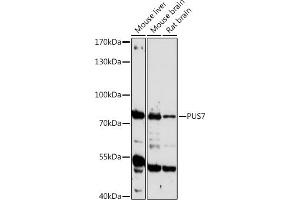 Western blot analysis of extracts of various cell lines, using PUS7 antibody (ABIN7269739) at 1:1000 dilution. (PUS7 antibody  (AA 352-661))