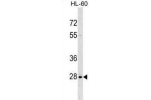 Western Blotting (WB) image for anti-Peptidylprolyl Isomerase (Cyclophilin)-Like 6 (PPIL6) antibody (ABIN2999694)