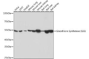 Western blot analysis of extracts of various cell lines, using Glutathione Synthetase (GSS) (GSS) Rabbit mAb (ABIN7267452) at 1:1000 dilution. (Glutathione Synthetase antibody)