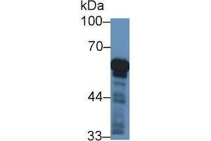 Detection of CYP11B1 in Rat Adrenal gland lysate using Polyclonal Antibody to Cytochrome P450 11B1 (CYP11B1)