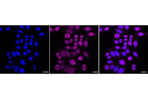 anti-Phosphopantothenoylcysteine Synthetase (PPCS) antibody
